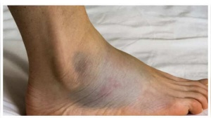 Skin Deep: 7 Clues Your Skin May Be Signaling Heart Problems
OR
Your Skin's Secrets: 7 Warning Signs That Could Indicate Heart Disease
OR
Hidden Heart Clues: How Your Skin Could Be Warning You About Heart Trouble