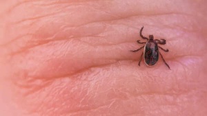 Fitness Advocate Paralyzed by Tick Bite: A Warning About Babesiosis and Outdoor Safety