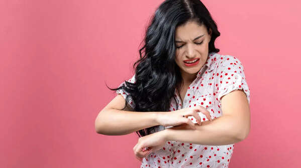 Identifying moles that exhibit itching, pain, or bleeding