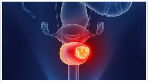 Lower back pain illustration