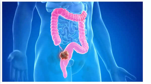 Unexpected weight loss should be checked out