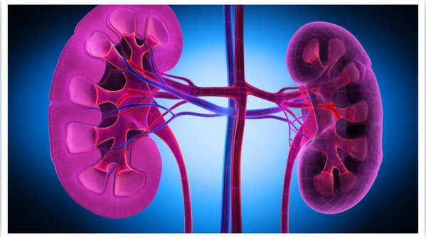 Illustration depicting damaged kidneys due to uric acid crystals