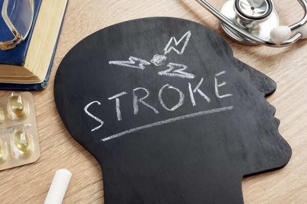 Doctor explaining stroke risks