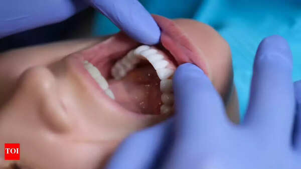 Symptoms of oral cancer, including mouth sores and patches.